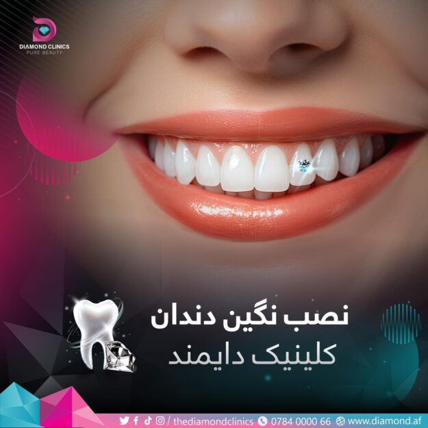 Diamond Dental Clinic